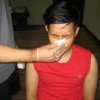 Hemophilia